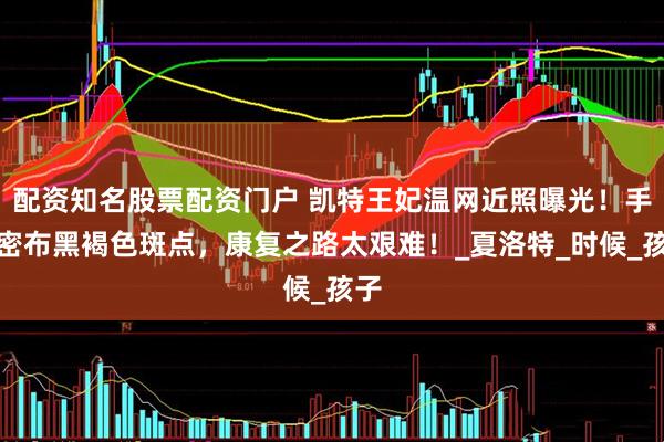 配资知名股票配资门户 凯特王妃温网近照曝光！手臂密布黑褐色斑点，康复之路太艰难！_夏洛特_时候_孩子